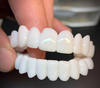 WhiteSnap™ Aligneur Blanc Invisible – 100% Ajustable et Sans Perforations