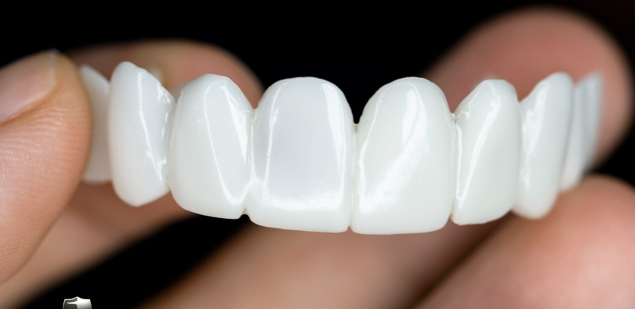 WhiteSnap™ Aligneur Blanc Invisible – 100% Ajustable et Sans Perforations