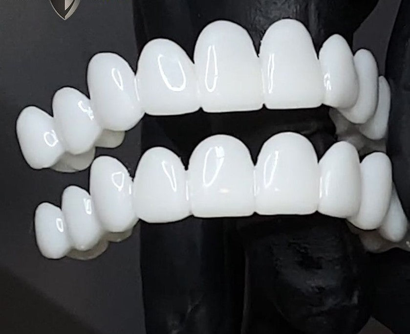 WhiteSnap™ Aligneur Blanc Invisible – 100% Ajustable et Sans Perforations