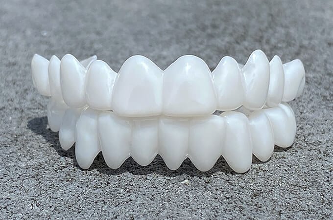 WhiteSnap™ Aligneur Blanc Invisible – 100% Ajustable et Sans Perforations