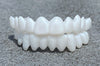 WhiteSnap™ Aligneur Blanc Invisible – 100% Ajustable et Sans Perforations