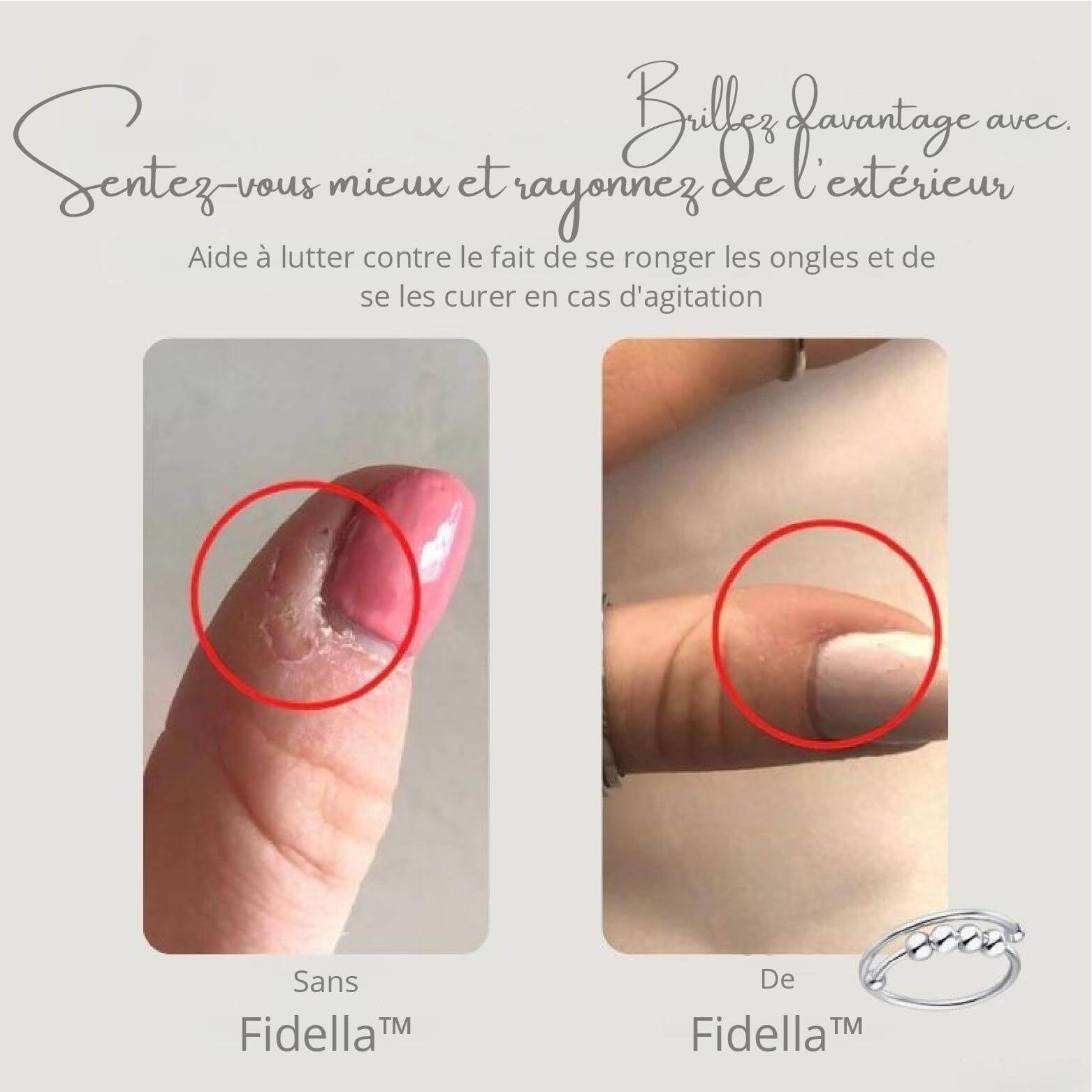 Fidella™ – Anneau Anti-Stress Réglable avec Perles Tournantes
