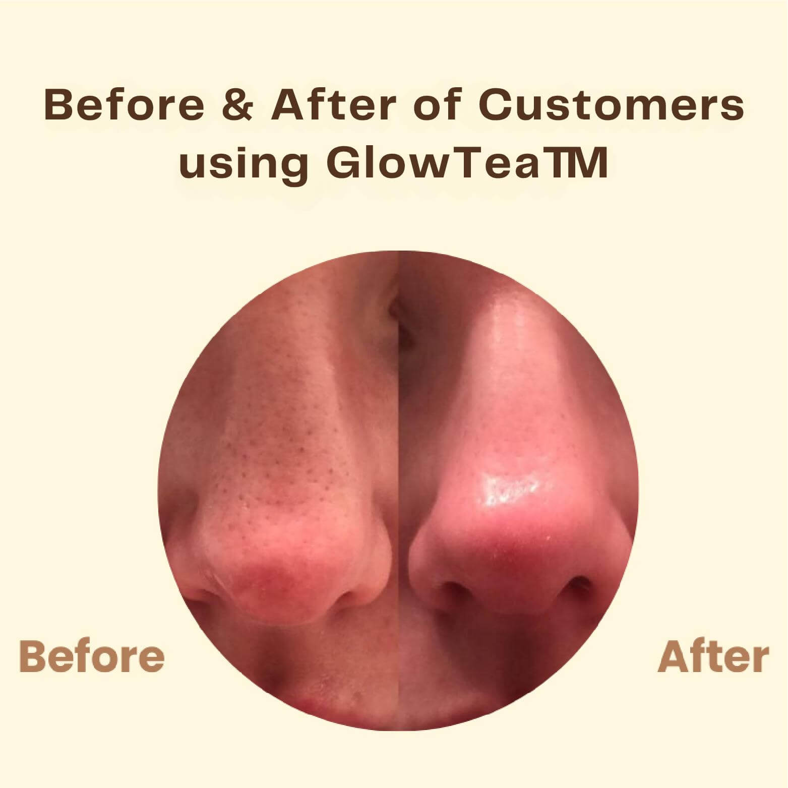 Dernier Jour - 50% de Réduction 🔥 | Masque au Thé Noir GlowTea™