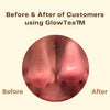 Dernier Jour - 50% de Réduction 🔥 | Masque au Thé Noir GlowTea™
