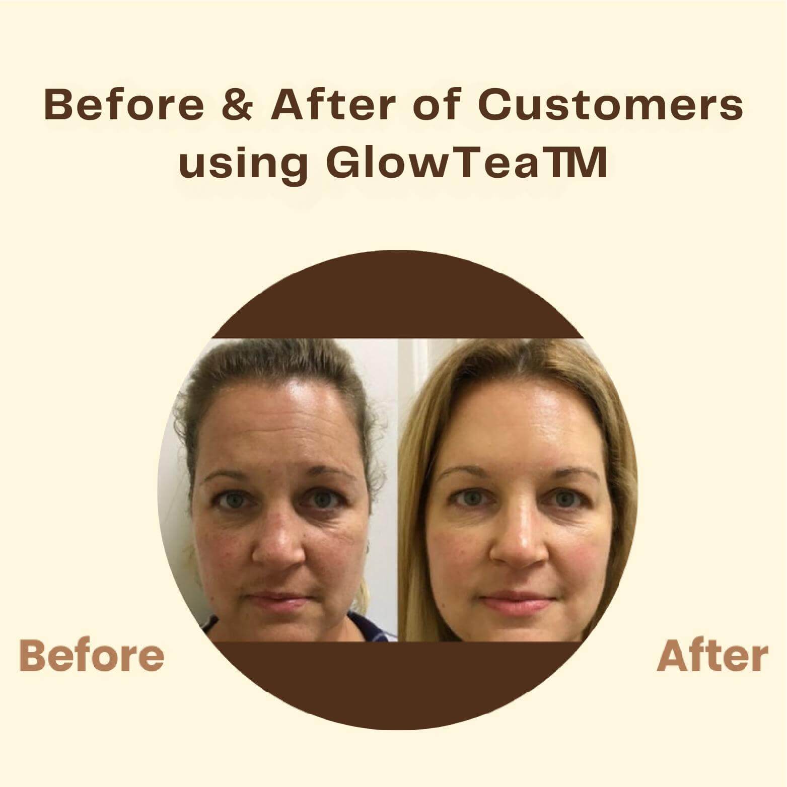 Dernier Jour - 50% de Réduction 🔥 | Masque au Thé Noir GlowTea™