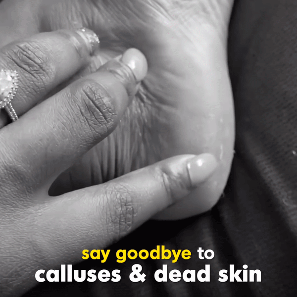 Smoother™ - Râpe Électrique Professionnelle Anti-Callosités